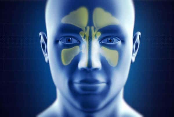 Xylitol Nasal Irrigation in the Management of Chronic Rhinosinusitis